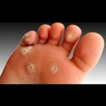 محلول میخچه درجه یک تضمینی