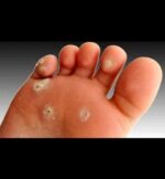 محلول میخچه درجه یک تضمینی